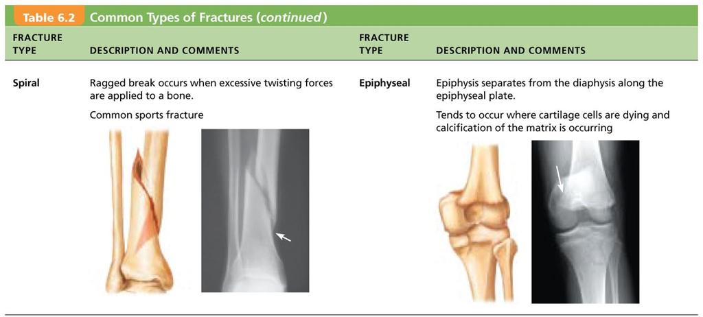 Immobilization cast or splint C. Repair Process: 1.