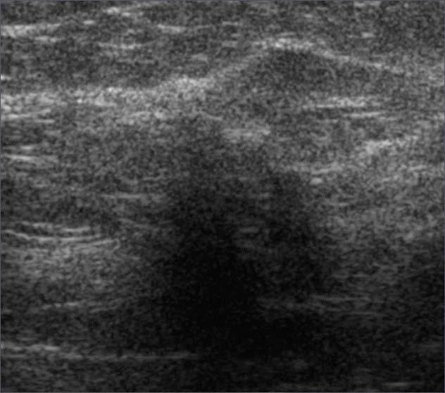 Issues With Ultrasound Screening