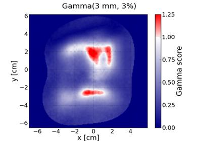 5.3.1.2 MOSAIQ Measurements: MatriXX versus Eclipse (3 mm, 3%), Field: ERAPB Figure 3: Gamma analysis for field ERAPB (gantry = 295 ).