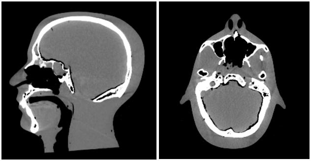 Figure 3-2: Sagittal and Axial CT scan of the original head phantom purchased prior to modifications To be an appropriate quality assurance phantom for proton trials the head phantom had to include