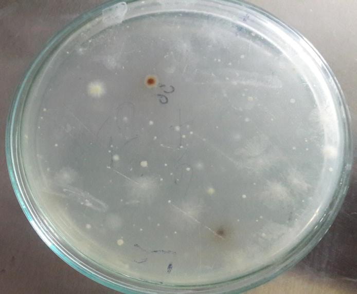 Culture method Preparation of Nutrient Agar medium: Composition: Yeast extract 0.4g Peptone 1.0g Sodium chloride 1.0g Agar 3.0g Distilled water up to 200ml Procedure: 1.