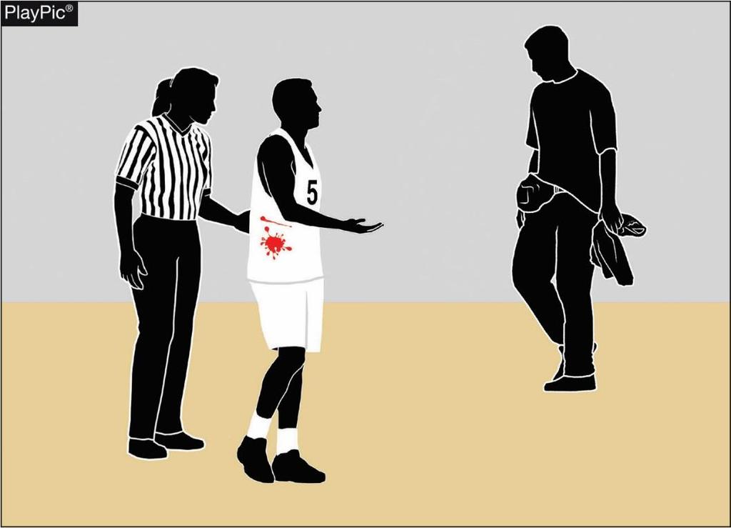 SPORTS MEDICINE: PROPER MANAGEMENT OF BLOOD ISSUES Rule 3-3-7 specifically details that a player who is bleeding, has an open wound, has any amount of blood on his/her