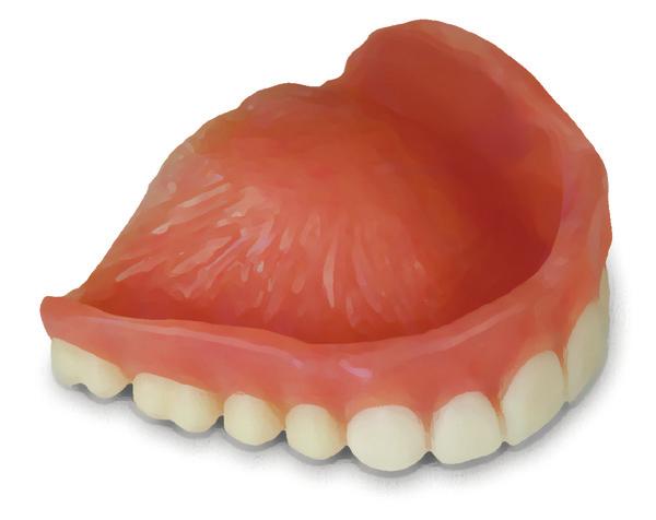 Know the Anatomy of Your Denture It is CRITICAL you understand and apply these concepts to create a proper fit. You have ONE SHOT to get it right.