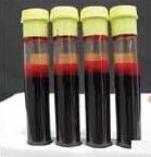 5 ml each x 4 tubes) of whole blood