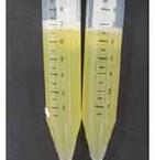 sterile tubes Collection of platelet