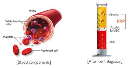 Blood components Blood components : - 93% RBCs -