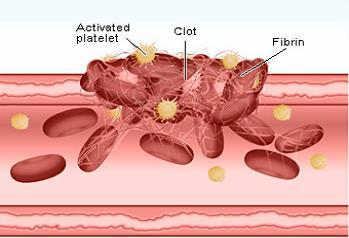 Platelets Platelet are derived from megakaryocytes Important in hemostasis