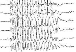 Hz. Faster rhythms (i.e. beta) seem to be generated by the cortex itself. 3 What function does the EEG serve? As yet there is no clear-cut answer to this question.