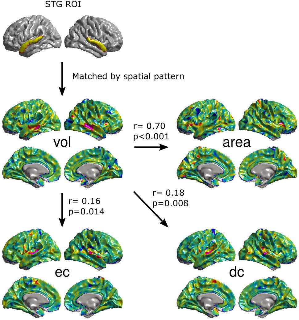 Brain Struct Funct (2016) 221:4459 4474 4469 Fig. 5 A sub-study focusing on the cortical volume of STG.