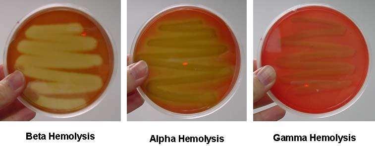 A- One of the most important characteristics for identification of streptococci