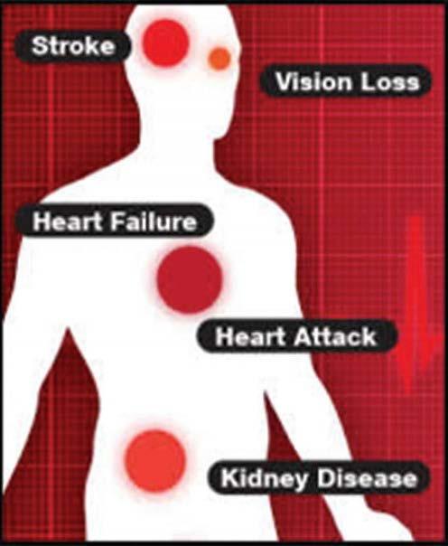 Consequences Hypertension makes the heart work harder to get blood and oxygen where it needs to go Can cause hardening
