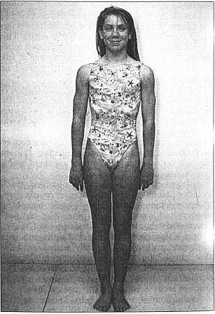 General appearance examination The athlete stands straight with arms to