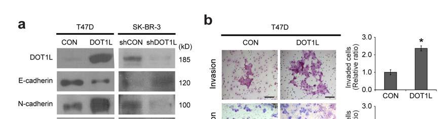 Supplementary Figure 3 Effect of DOT1L on EMT and invasion ability in human breast cancer