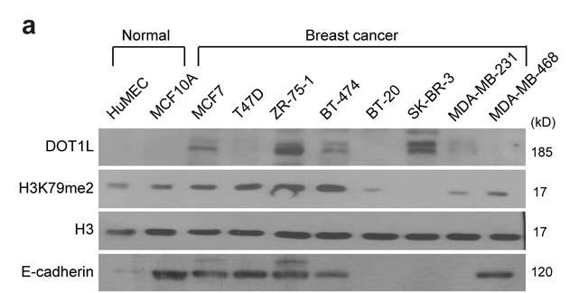 Supplementary Figure 4 DOT1L expression in breast normal and cancer cell lines and breast CSCs.