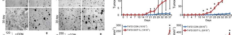 tumor growth in stable DOT1L-overexpressing and Tet-inducible DOT1L shrna-expressing