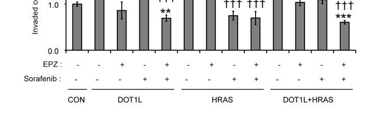 Supplementary Figure 7 DOT1L and HRAS effect on breast cancer migration and invasion in MCF10A cells.