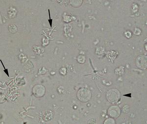 Bacteria 1. Normal microbial flora of the vagina or external urethral meatus 2.