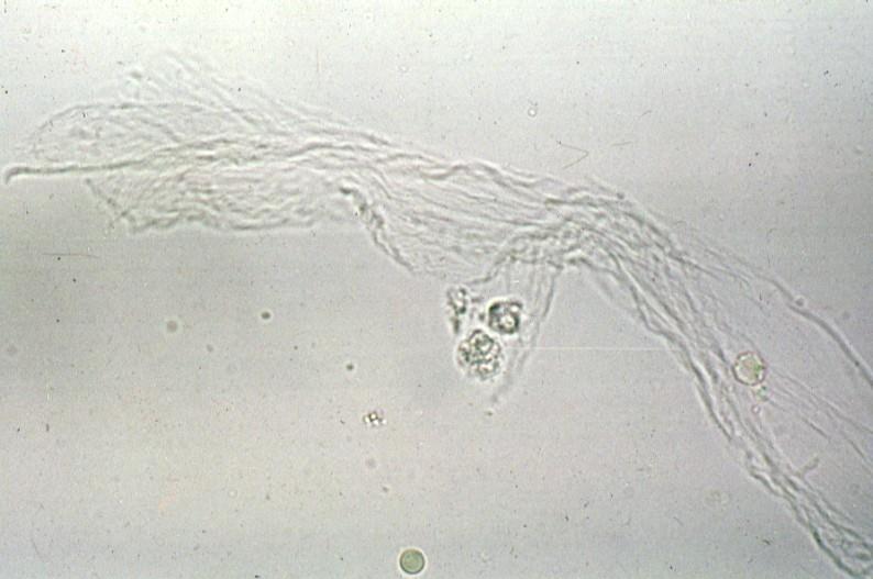 Miscellaneous Spermatozoa can