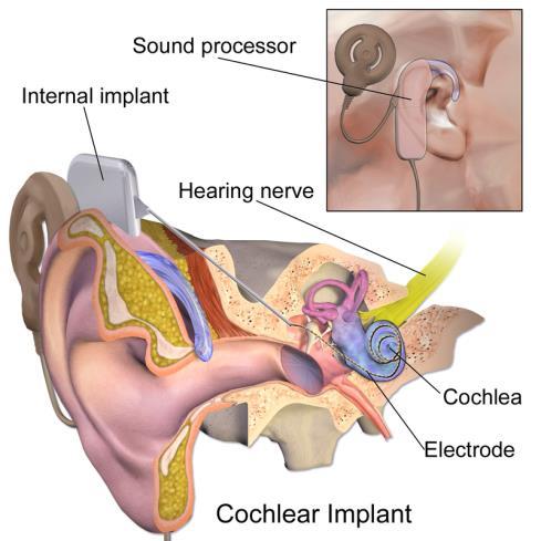 as audiology (diagnostic