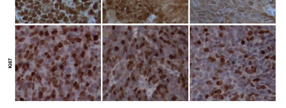 Sequential tumor samples were taken from the same mouse with a VCaP xenograft at
