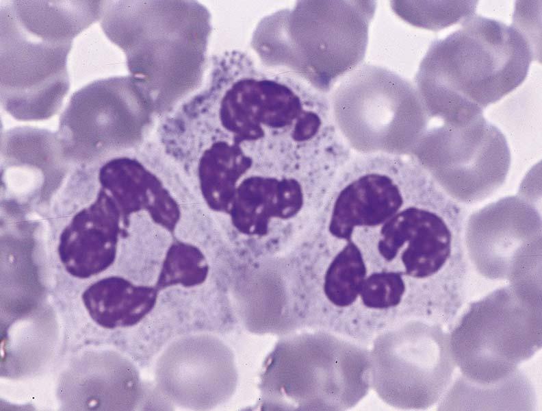 Neutrophils Constitute 60-70% of circulating leukocytes 12-14µm in diameter (in blood smear) Nucleus consisting of 2-5 (usually 3) lobes connected by fine threads of