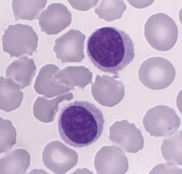 A family of spherical cells with similar morphological characteristics Small lymphocytes with 6-8 µm in diameter Has spherical nucleus Its chromatin is condensed and appears as coarse clumps