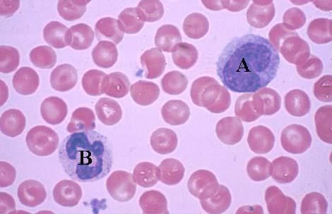 lighter Cytoplasm is basophilic and may contain very fine azurophilic granules, which gives cytoplasm a