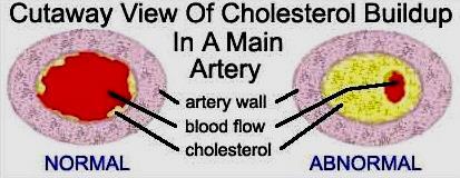 Not all of it. Cholesterol is produced naturally in the liver.
