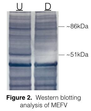 2 ul of loading dye was added to each RT-PCR product. 5 ul of each product was then added to a 1% agarose gel, and electrophoresis was performed at 160 V.