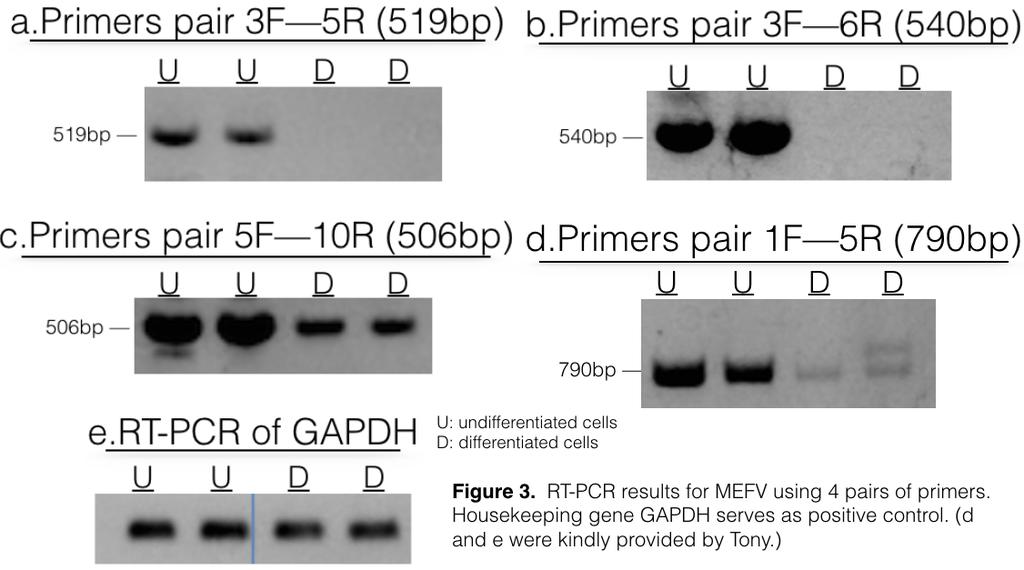 2 3 Discussions We have demonstrated in this project that MEFV gene expression is altered during cell differentiation. Expression of certain peptides are largely reduced in differentiated cell.