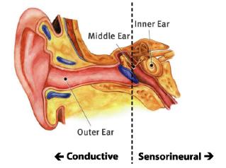 inflammamon Hearing loss sets this condimon apart from FCAS as