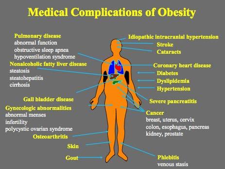 Impact of Overweight and Obesity Overweight and obesity are connected to an increase in many health risks,