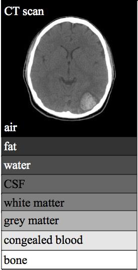 Doing a CAT scan involves putting the subject in a special, donut-shaped x-ray machine.