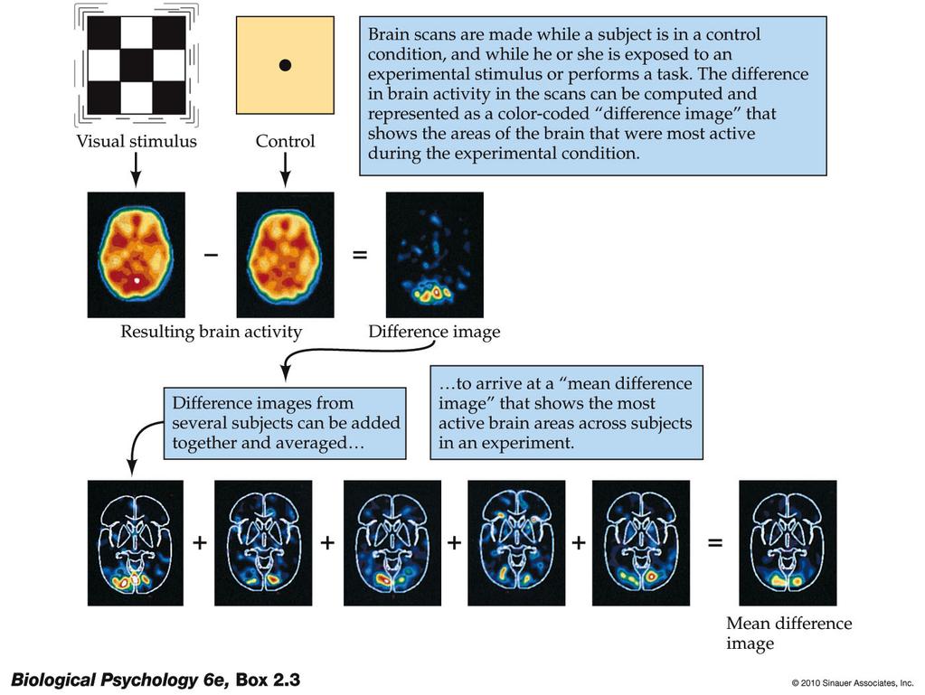 Functional magnetic resonance imaging (fmri) uses MRI but also measures of haemodynamic (blood-oxygen) levels reflecting neural activity in the brain.