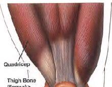 IV-Common Ailments (Knee) Arthritis