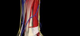 IV-Common Ailments (Ankle / Foot) Ankle sprain Heel Spur Planter