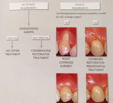Tooth Hypersensitivity Plaque Accumulation Is there plaque accumulation due to an irregular gingival margin? Questions to Ask: Diagnosis Is the recession a cosmetic concern?