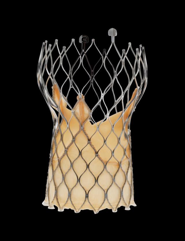 Medtronic CoreValve Evolut Redesigned release mechanism for ease of separation from delivery catheter Shorted outflow More consistent inflow radial force to reduce paravalvular regurgitation Longer
