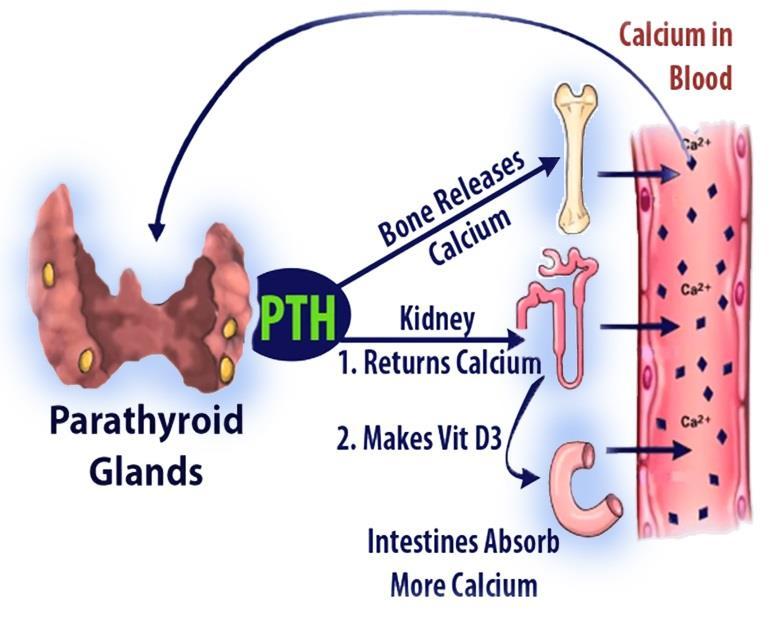 Introduction: primary hyperparathyroidism (PHPT) PHPT is a disease of improper calcium regulation Osteoporosis, fractures, bone pain Kidney stones GERD