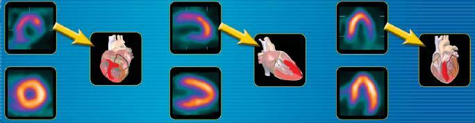 Myocardial Perfusion Summed images are used to assess cardiac perfusion.