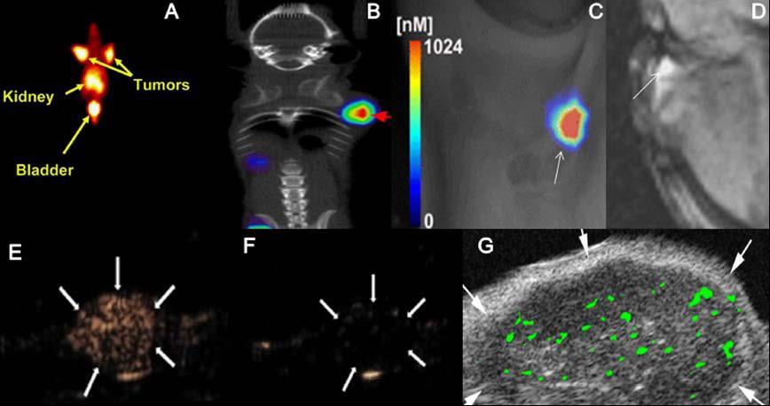 Tumor Angiogenesis Molecular imaging of the αvβ3 integrin: A - SPECT B - PET C - optical imaging D - MRI E - xenograft tumor after injection of microbubbles conjugated with