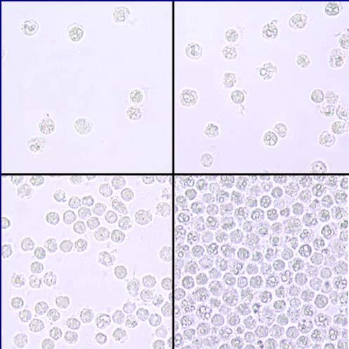 objective White blood cells a few are normal high numbers indicate