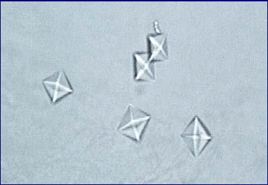 Crystals of calcium oxalate colorless