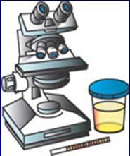 What is Urinalysis? It provides information about: The state of the kidney and urinary tract.