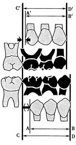 The second stage of development In the second stage of permanent teeth development: the C, D and E are replaced by 3, 4, and 5.