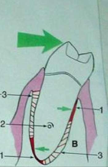 Horizontal occlusal force causes the tooth to - rotate about an axis (2) - demonstrates an