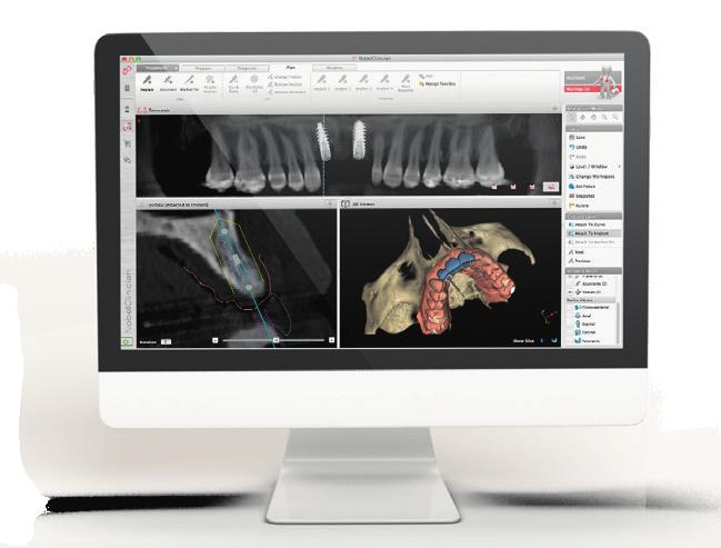 Integrated treatment workflow Diagnostic imaging in clinical practice Numerous scientific papers have demonstrated the crucial role of cone beam computed tomography (CBCT) imaging in the field of