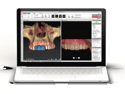 Full integration of all therapeutic steps Today, digital workflows allow full integration of therapeutic steps from patient diagnostics and treatment planning to surgery and prosthetic