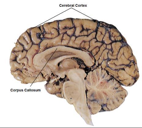The Cerebral Cortex The intricate fabric of interconnected neural cells that covers the cerebral hemispheres.
