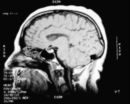 types of brain tissue. Both photos from Da